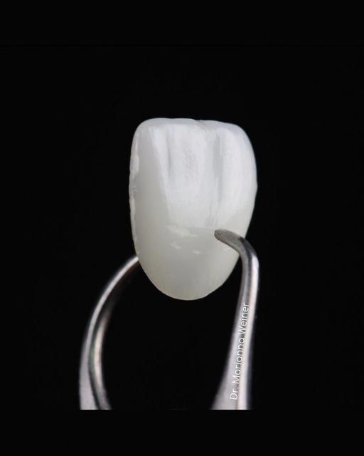 Polished ceramic crown held in tweezers
